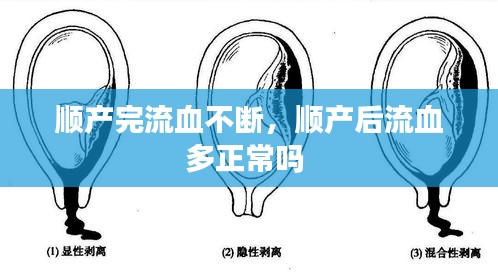 顺产完流血不断，顺产后流血多正常吗 