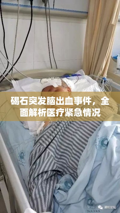 碣石突发脑出血事件，全面解析医疗紧急情况